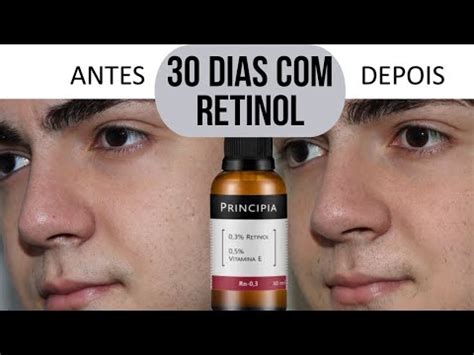 retinol b3