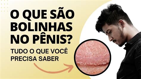 bolinhas na língua