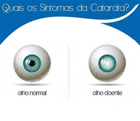 olhos nos olhos