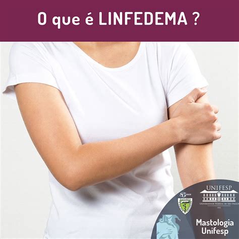 linfedema nas pernas fotos