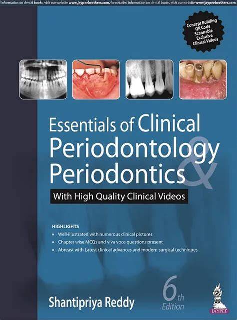 (OLD EDITION) Textbook of Periodontics