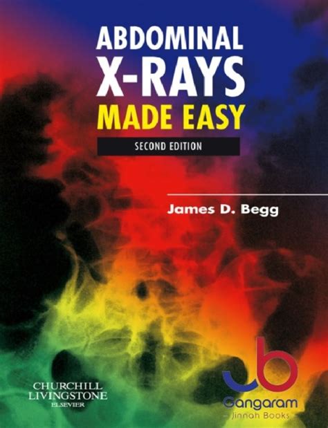 Abdominal X-Rays Made Easy
