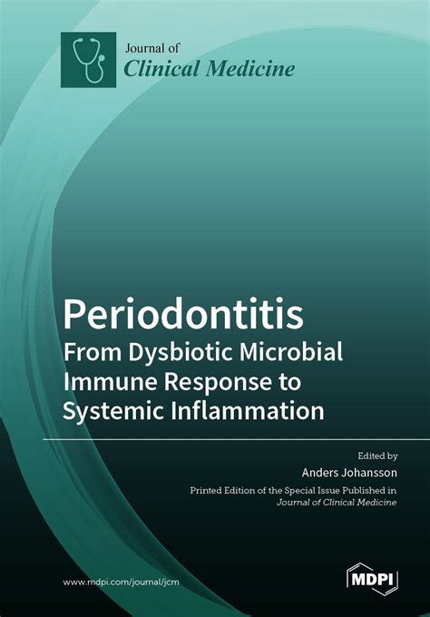Advanced periodontitis