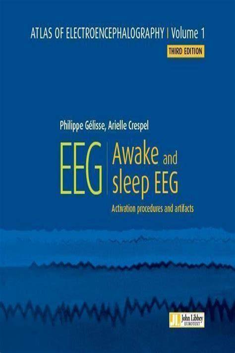 Atlas of Digital EEG