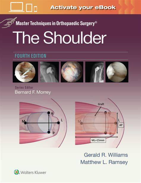 Atlas of Orthopaedic Shoulder Implants