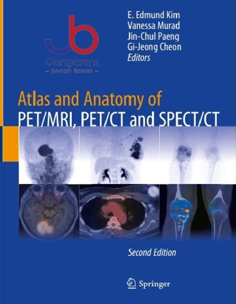 Atlas of Spect-CT