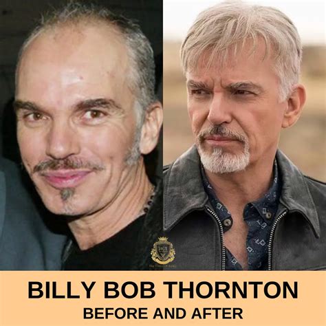 Billy Bob Thornton