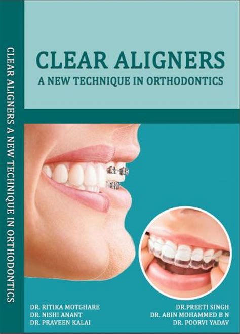 CLEAR ALIGNERS