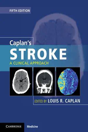 Caplan Stroke: Clinical Practice