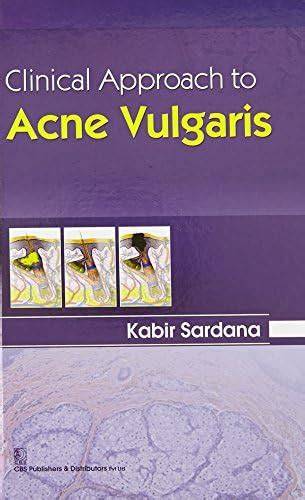 Clinical Approach to Acne Vulgaris