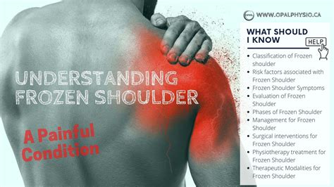 Complete Guide to Frozen Shoulder