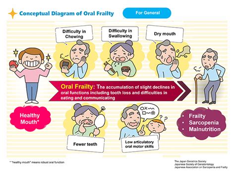 Exercise Therapy to Improve Frailty (Japanese Edition)