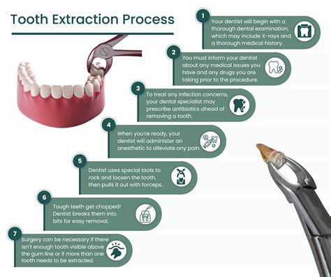 HandBook Extraction: Tools for Tooth Extraction Made Easy
