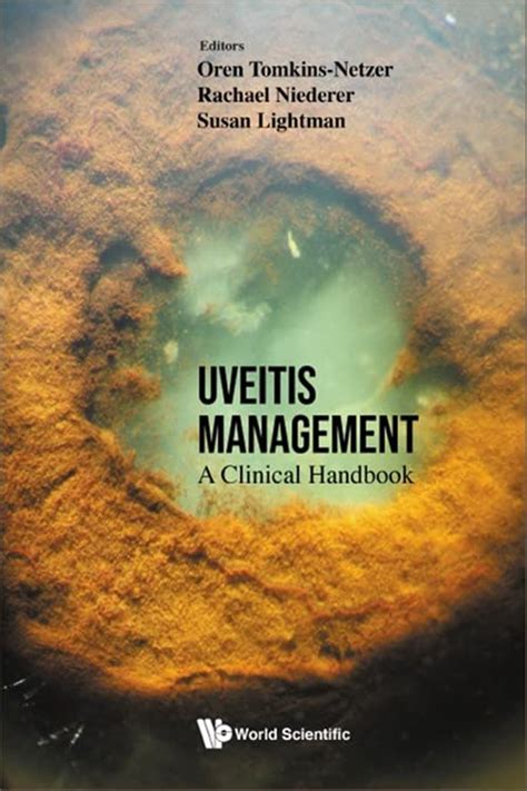 Handbook of Uveitis