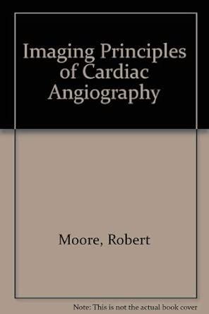 Imaging Principles of Cardiac Angiography