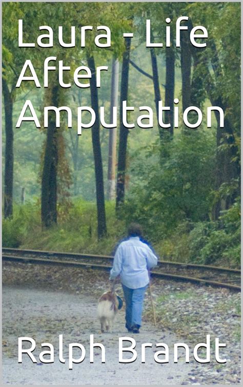 Laura - Life After Amputation