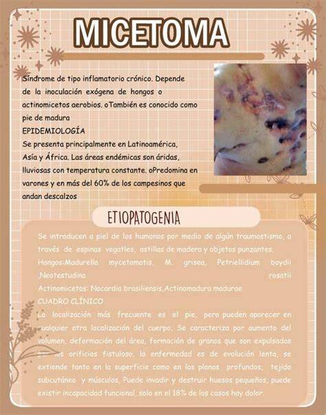 MICETOMA