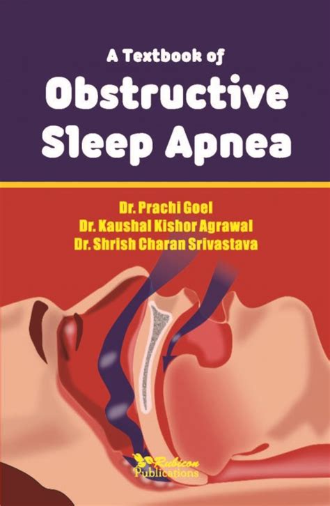 OBSTRUCTIVE SLEEP APNEA