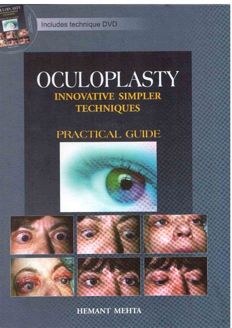 Oculoplasty: Innovative simpler techniques