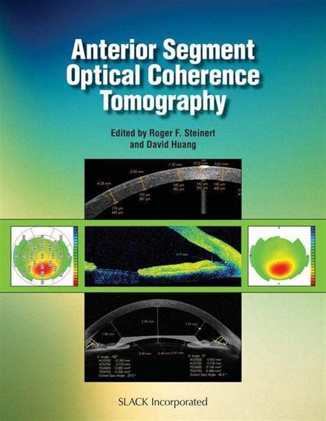 Optical Field Reconstruction Using Phase-Space Tomography