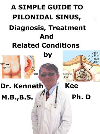 Pilonidal Sinus and Abscess