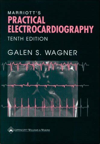 Practical Electrocardiography