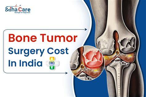 Practical bone tumor surgery school(Chinese Edition)