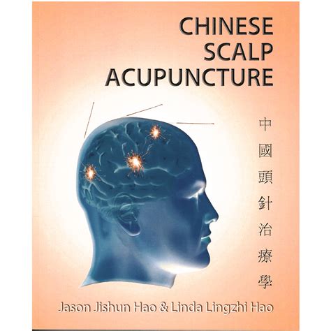 Scalp Acupuncture Science (Chinese Edition)