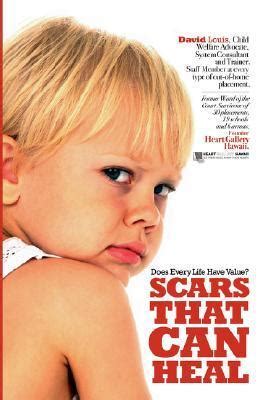 Scars That Heal