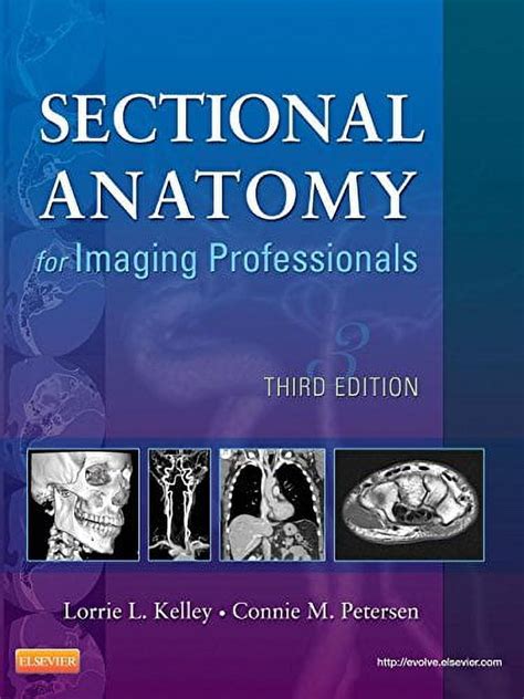 Sectional Anatomy for Imaging Professionals, 2e