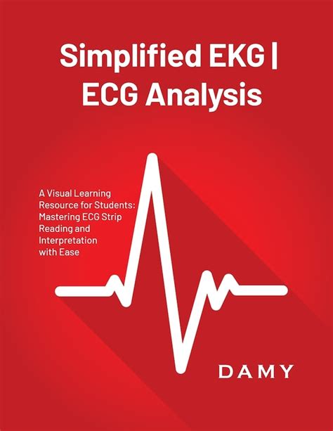 Sensible ECG Analysis
