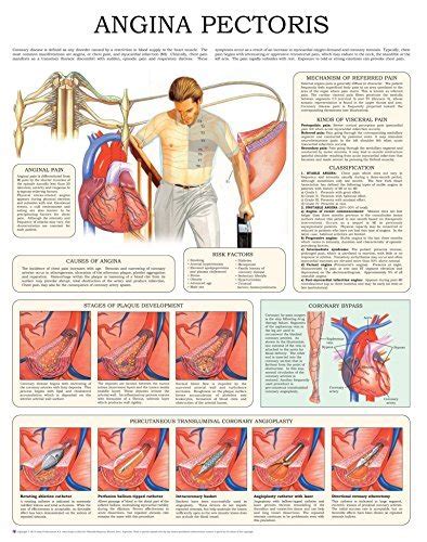Shoulder Pain e-chart: Quick reference guide