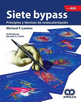 Siete Bypass