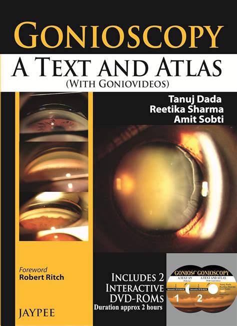 Slit-lamp gonioscopy,