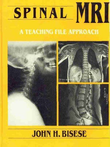 Spinal MRI: A Teaching File Approach