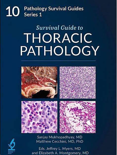 Survival Guide to Thoracic Pathology