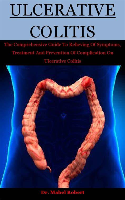 Ulcerative Colitis