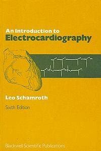 Understanding Electrocardiography