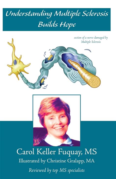 Understanding Multiple Sclerosis Builds Hope