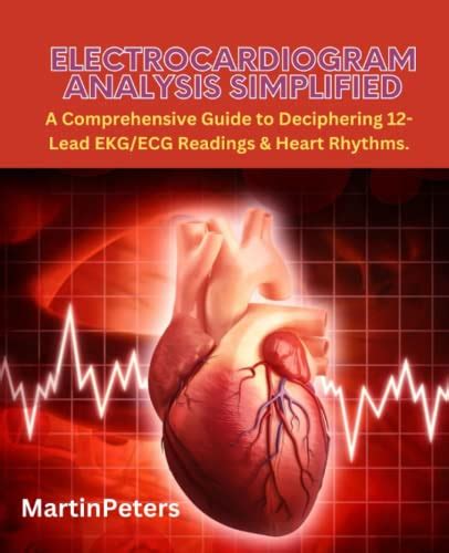 Understanding the electrocardiogram