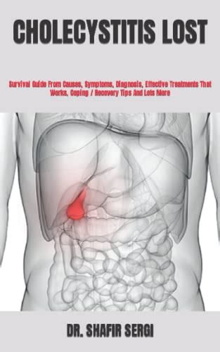 cholecystitis