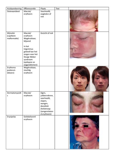 huidaandoening macula