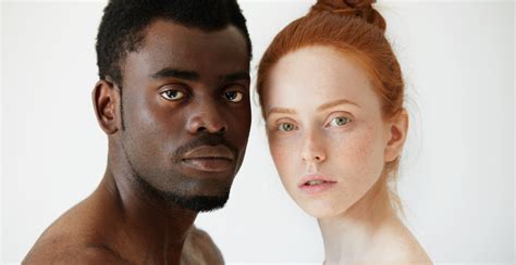 huidskleur verschillen