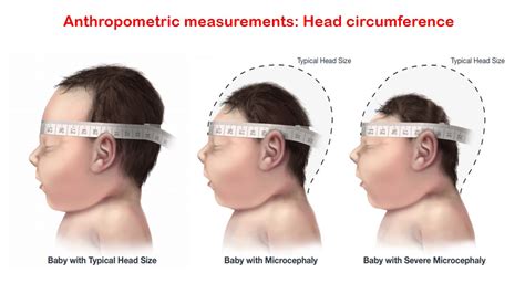 Human Head Circumference
