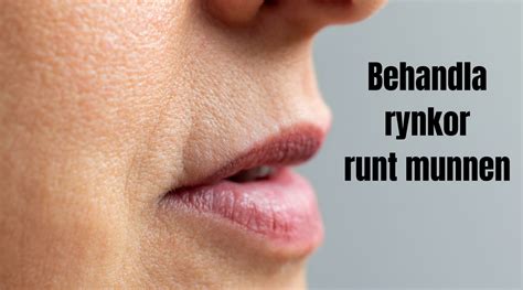 hur  bör munnen  titta ut