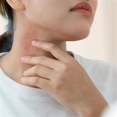 hur behandla svamp i