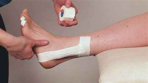 hur länge bandage stukad fot