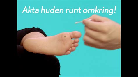 hur ofta behandla med