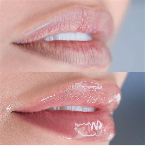 Hydra Gloss Lips