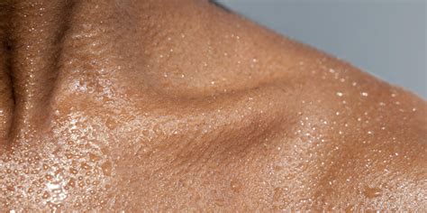 hyperhidrose definitie